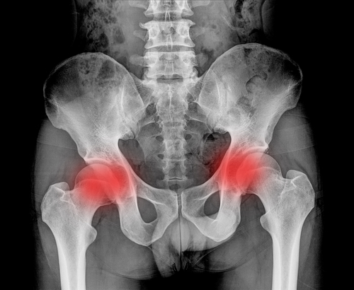 Is My Lower Back Pain From Sacroiliac Joint Dysfunction? 