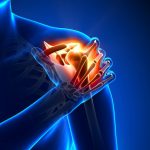 Orthopedics Diseases & Conditions — Center for Spinal Disorders