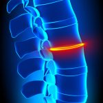 Spine & Back Diseases & Conditions — Center for Spinal Disorders