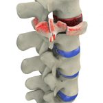 Spine & Back Diseases & Conditions — Center for Spinal Disorders