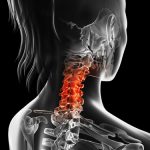 Spine & Back Treatments & Surgery — Center for Spinal Disorders