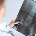Orthopedics Diseases & Conditions — Center for Spinal Disorders
