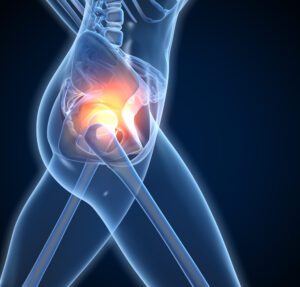 How to Relieve Hip Pain 