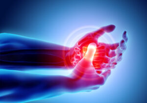6 Essential Facts About Rheumatoid Arthritis Remission