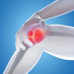 Osteoarthritis and Pain Relief