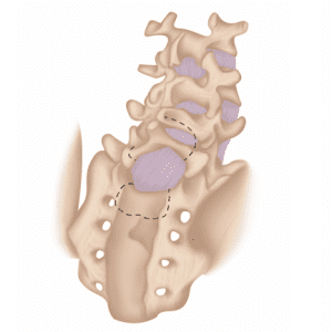 Dr. Janssen To Be Published In Tricks and Trades of Spine Surgery