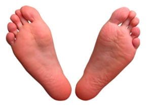 flat feet