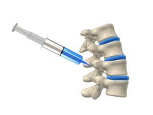 spinal injections