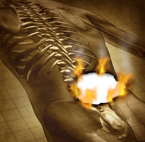 The Painful Effects Of Smoking: Chronic Back Pain